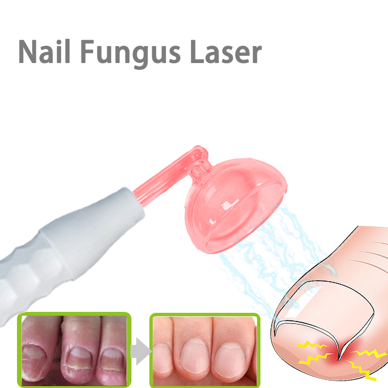 High Frequency Wand Facial Machine Neon - Appareil de soin du visage haute