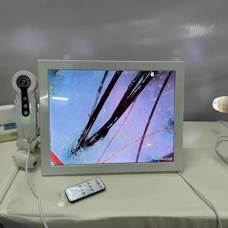 Analyseur de peau numérique HD - Skin Moisture Analyzer Digital Detector avis et prix