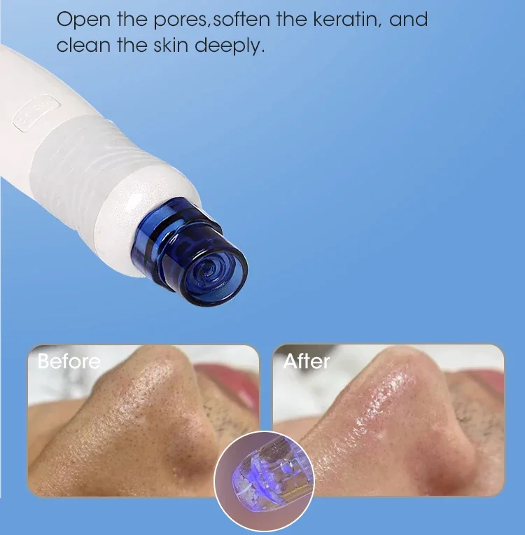 Vente chaude Spa utiliser l'hy - Hydro Facial Machine 7 In 1 avis et prix