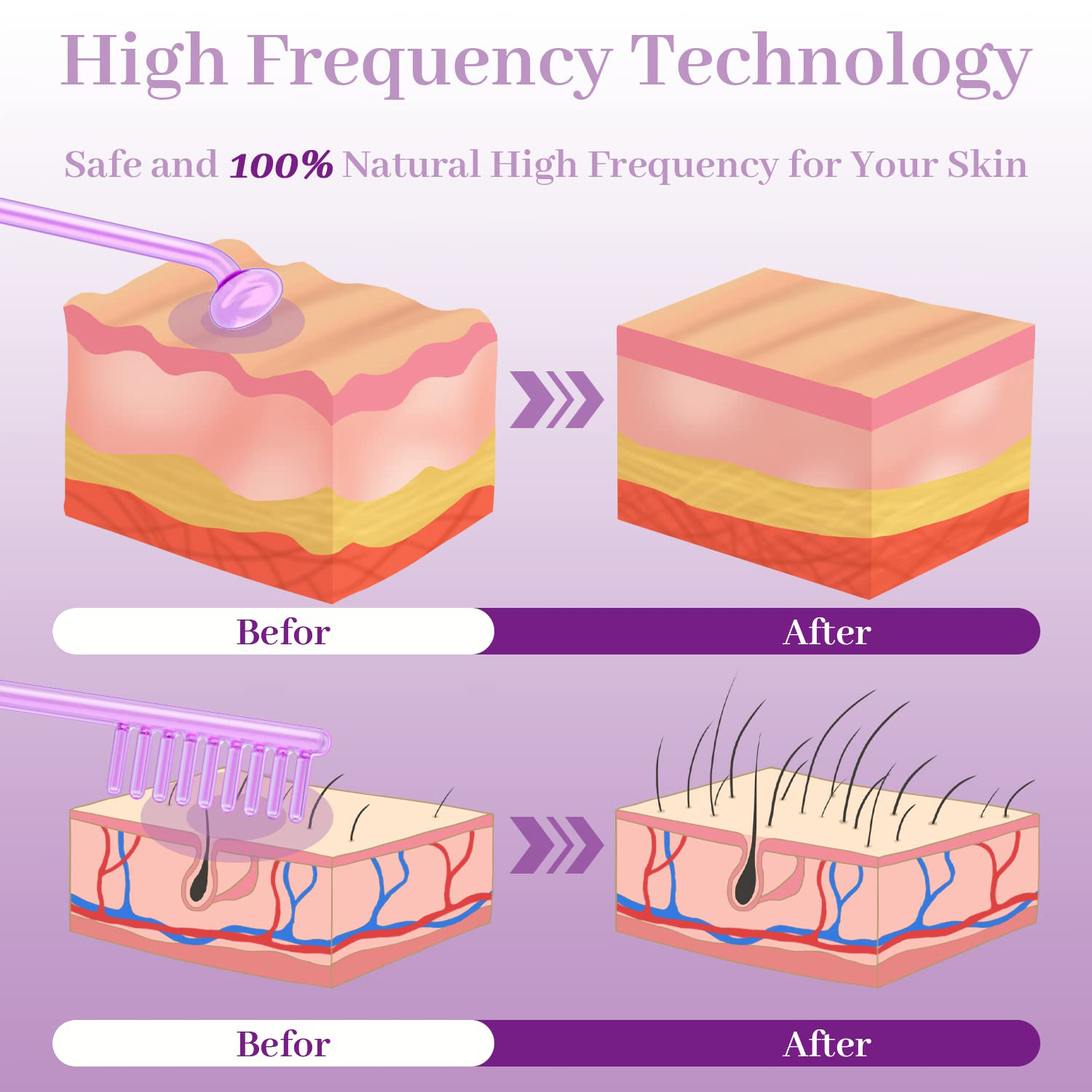 Appareil de beauté pour usage  - High Frequency Wand Facial Machine Neon avis et prix