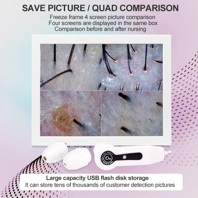 Analyseur de peau numérique HD - Skin Moisture Analyzer Digital Detector avis et prix