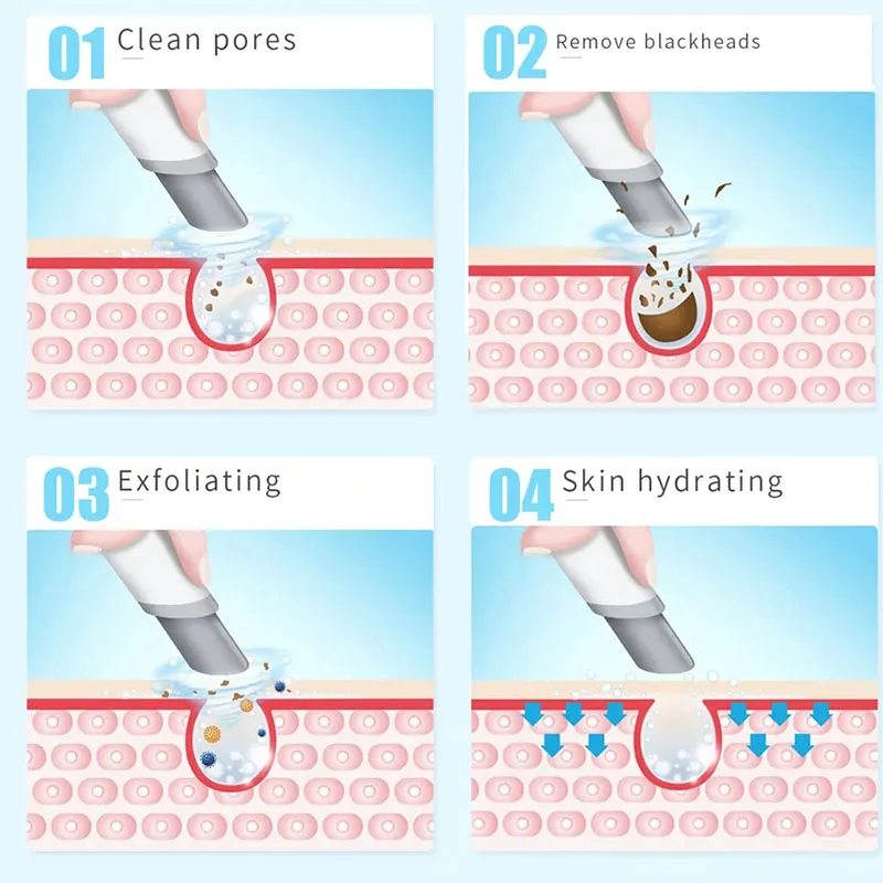 Nouveau dispositif de beauté P - Hydra Dermabrasion Aqua Peel Machine avis et prix
