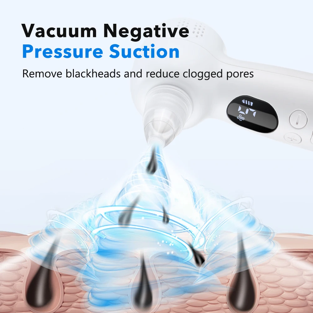 Aspirateur de Points Noirs Net - Blackhead Remover Vacuum Suction avis et prix