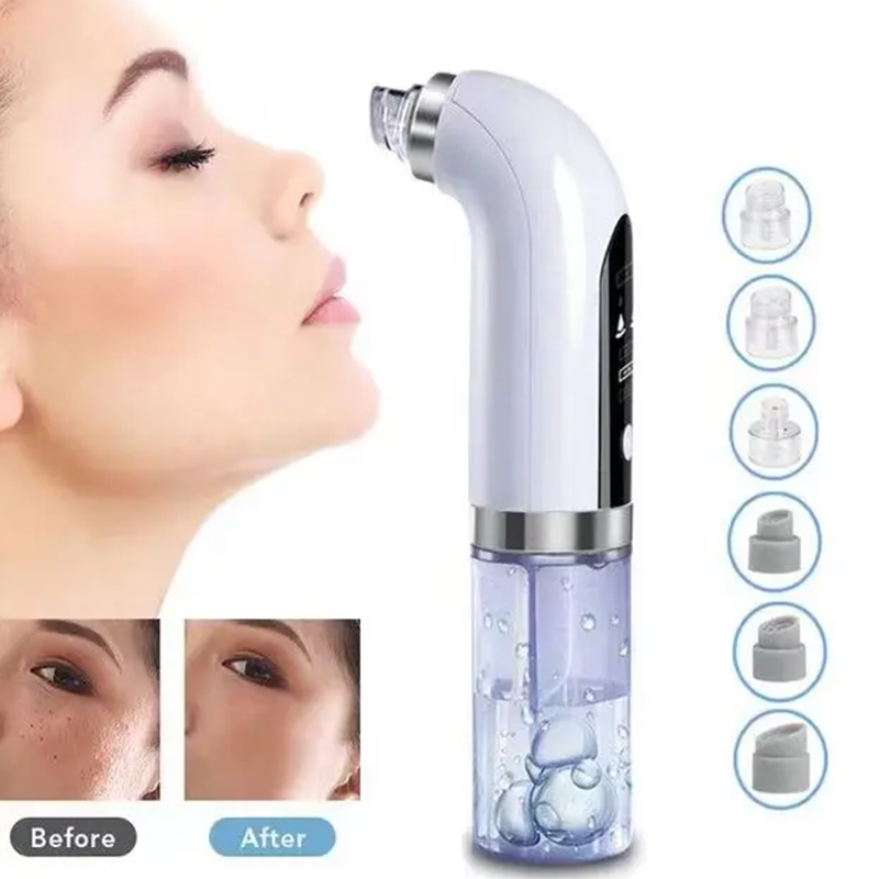 Appareil portatif de nettoyage - Blackhead Remover Vacuum Suction avis et prix