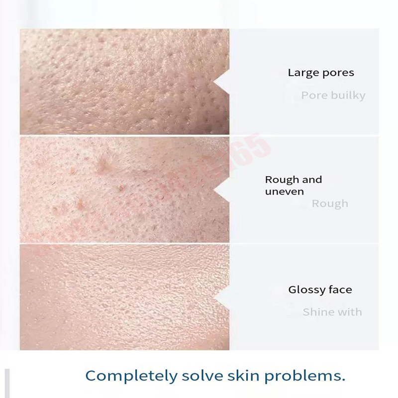 Solution de sérum Hydra pour l - Hydra Dermabrasion Aqua Peel Machine avis et prix