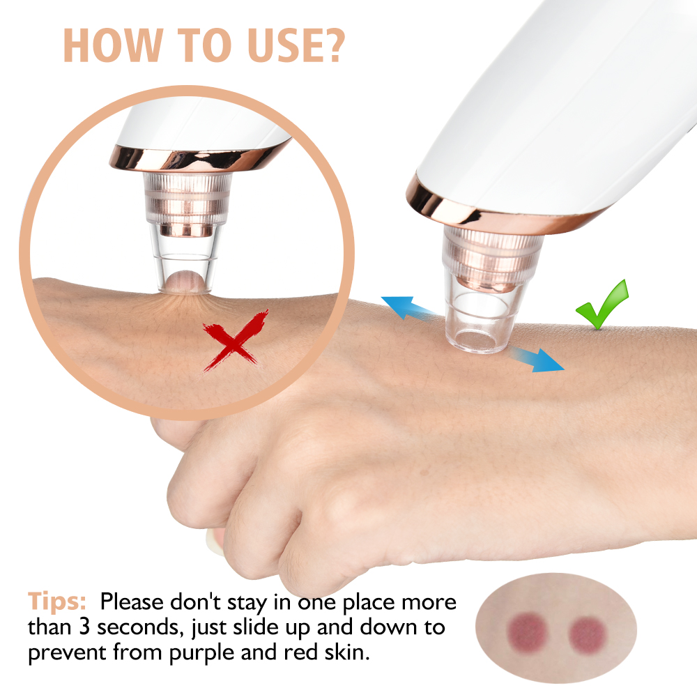Aspirateur de points noirs, ne - Blackhead Remover Vacuum Suction avis et prix