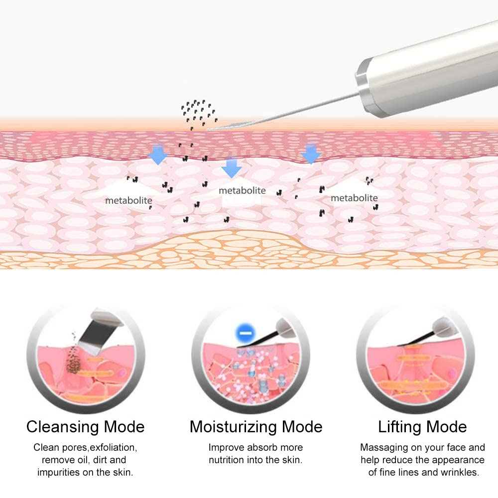 Épurateur de peau à ultrasons  - Blackhead Remover Vacuum Suction avis et prix