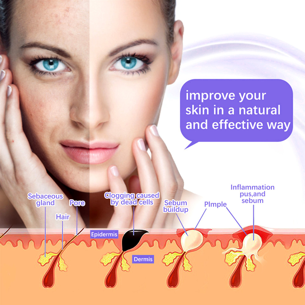 Machine de soins du visage 7 e - High Frequency Wand Facial Machine Neon avis et prix